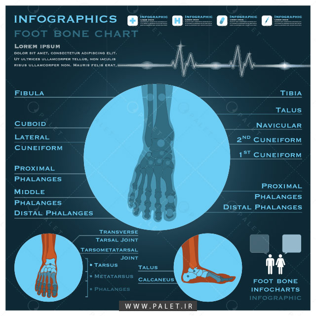 اینفوگرافیک ارتوپدی پا